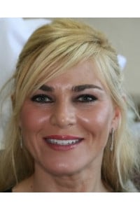 Konig Center for Cosmetic & Comprehensive Dentistry smile photos